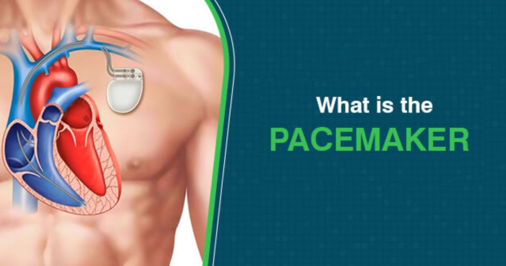 Pacemaker - Heart Specialist in Indore