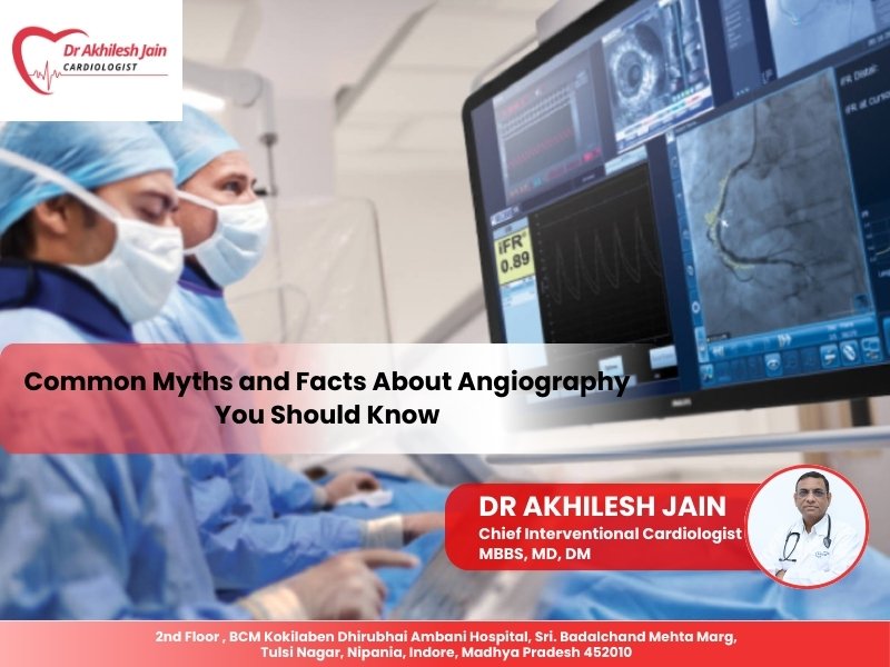 Doctors performing angiography procedure with advanced imaging screens – Dr. Akhilesh Jain, Cardiologist in Indore.