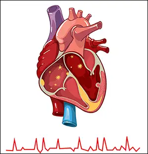 Medical illustration of a human heart with an irregular heartbeat pattern below, representing Atrial Fibrillation Treatment in Indore by Dr. Akhilesh Jain.