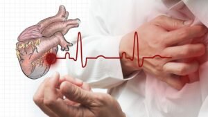 Heart attack symptoms and ECG warning sign for Heart Attack Treatment in Indore