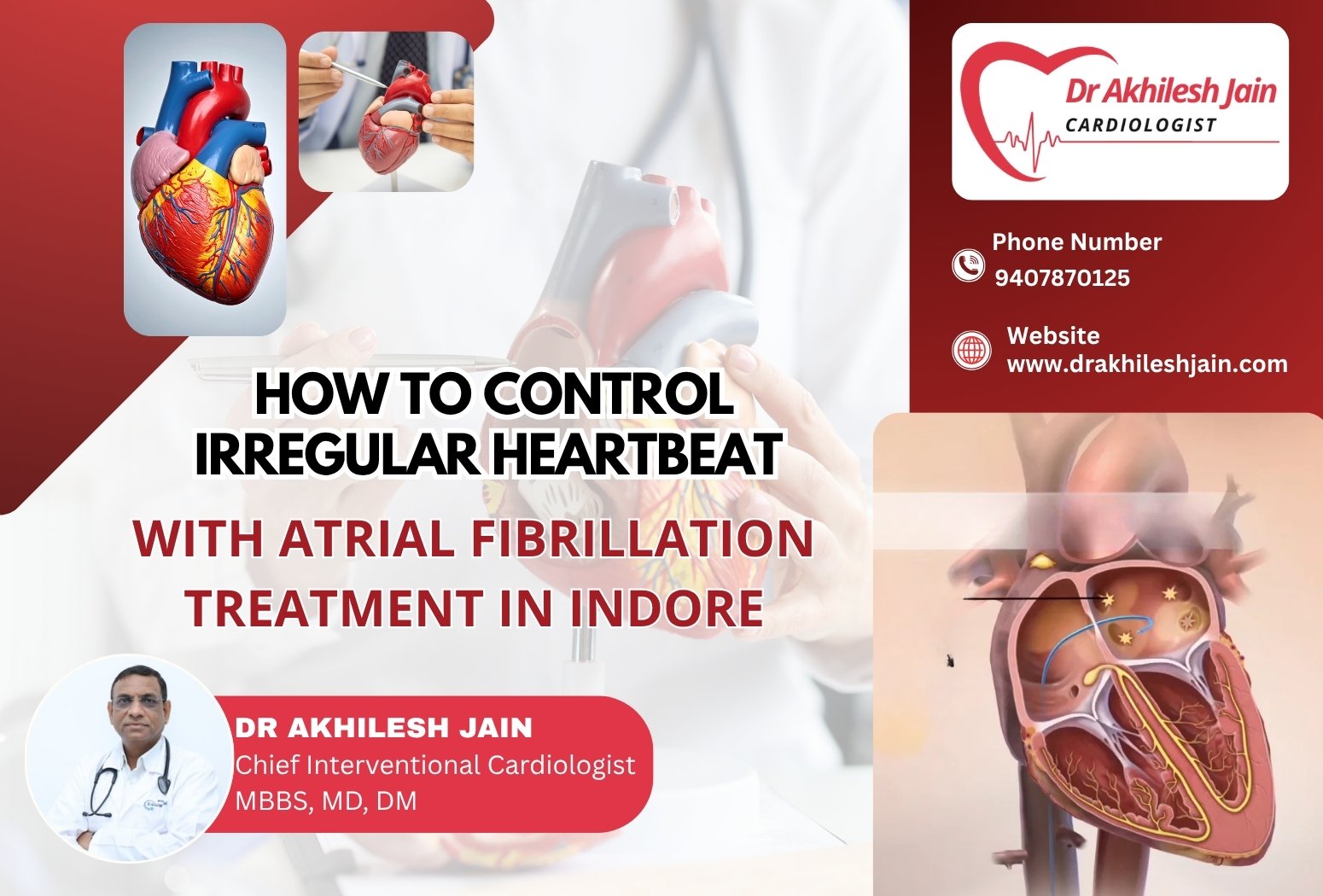 How to control irregular heartbeat with atrial fibrillation treatment in Indore by Dr. Akhilesh Jain with heart diagram.